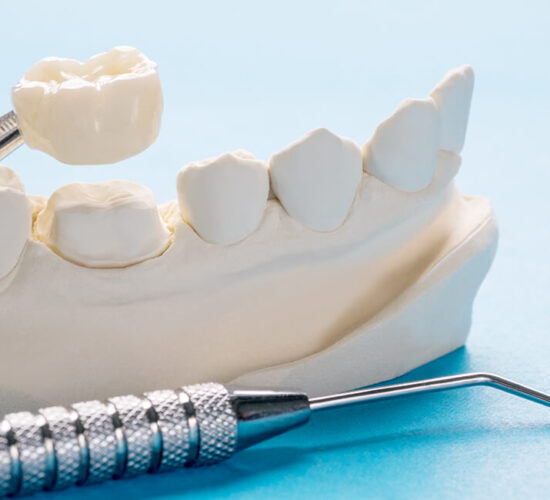 Zirconia Crowns